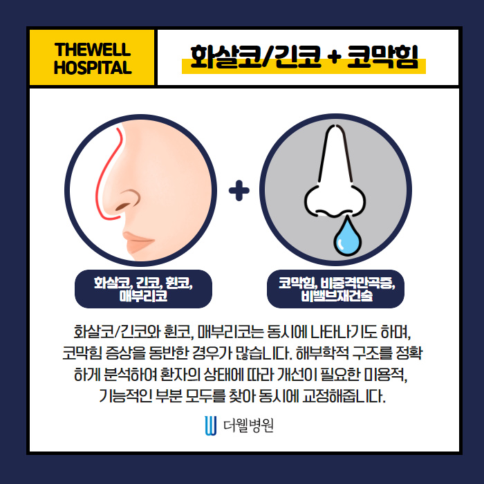 더웰병원 화살코·긴코 교정