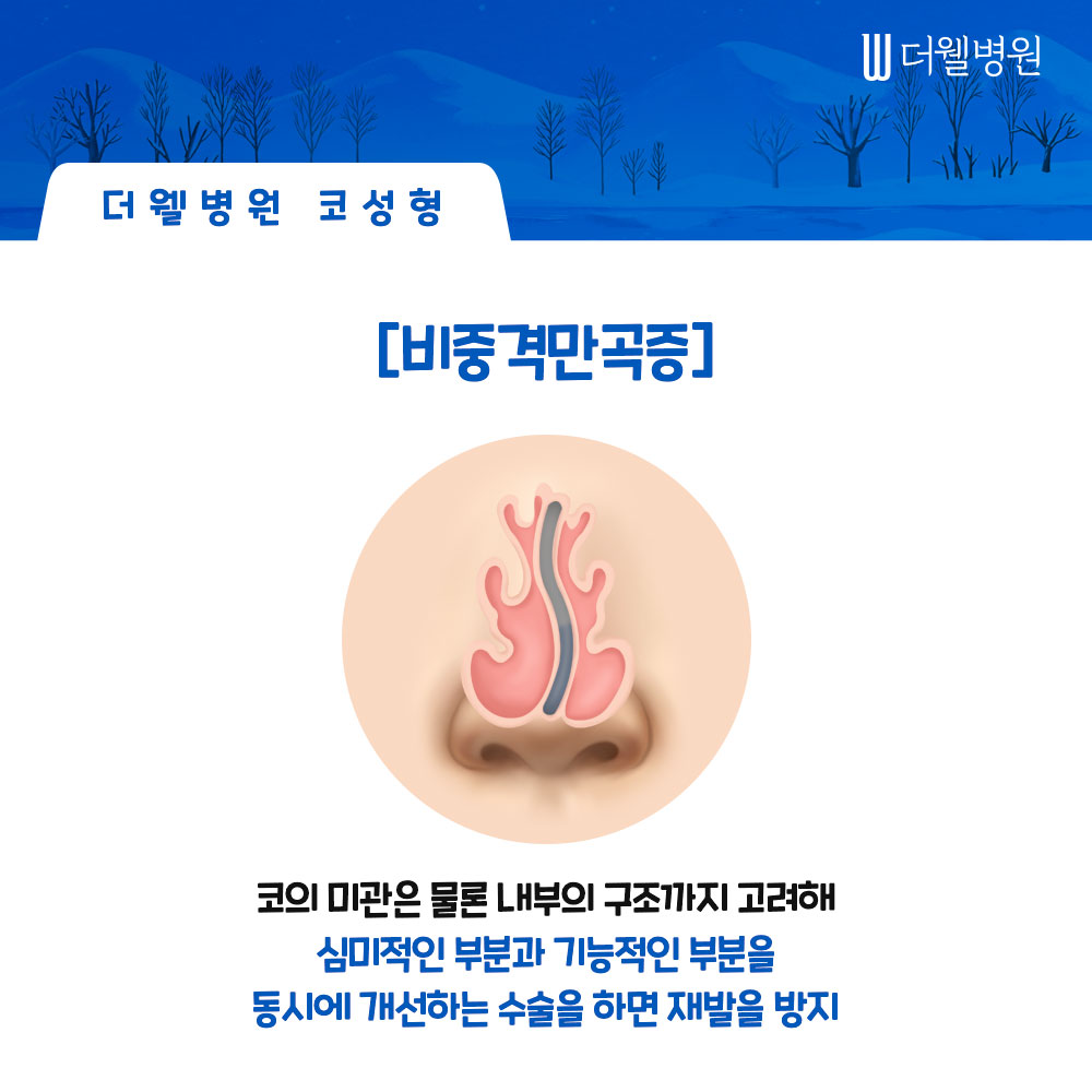 겨울철 늘어나는 비염, 약물로 치료가 안된다면 코성형이 필요한 이유! (5/8)