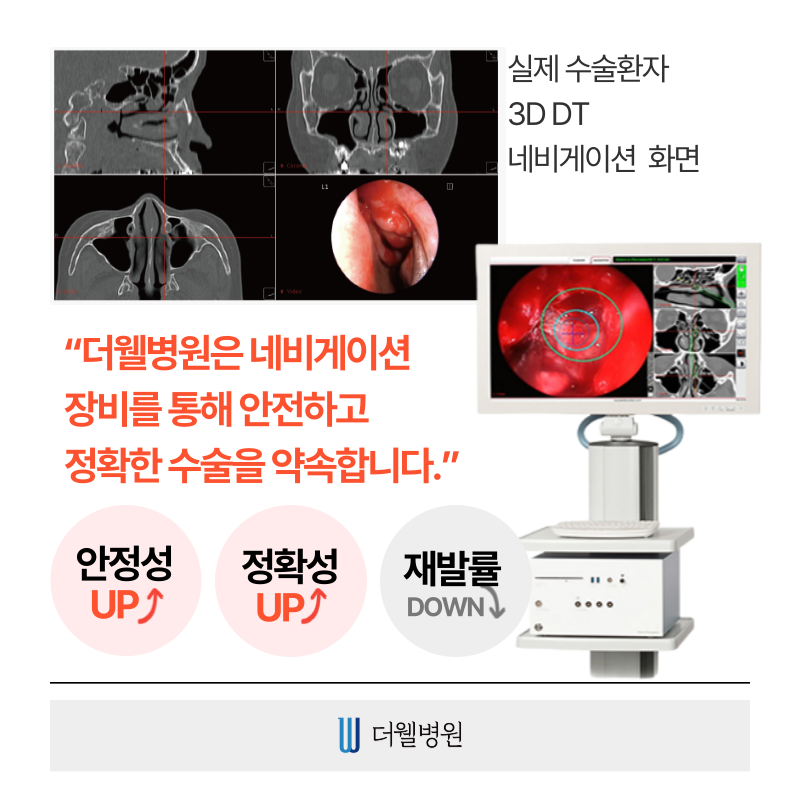 수원 기능코수술 _ 축농증 수술 이럴때 필요합니다! (9/12)