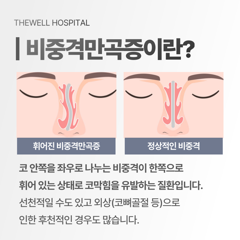 코막힘 치료 수원 더웰병원 _ 비중격만곡증이란 무엇인가요? 원인과 치료 방법 총정리 (3/10)